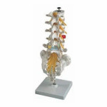 Lumbar Disc Herniation Model